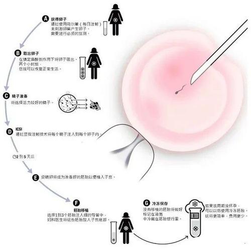 国外做试管代怀有哪些【国外试管代怀:全面解析代孕流程】