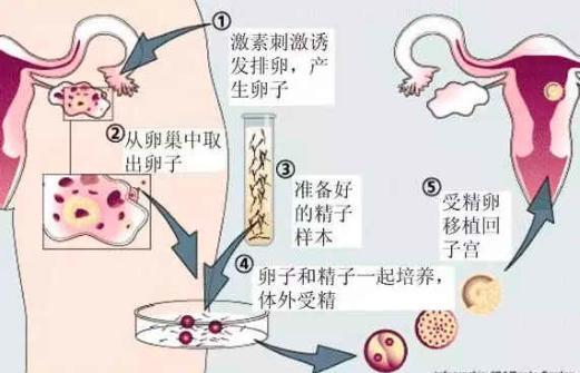 怎么当做试管代怀_试管代怀:如何选择合适的方式进行代孕